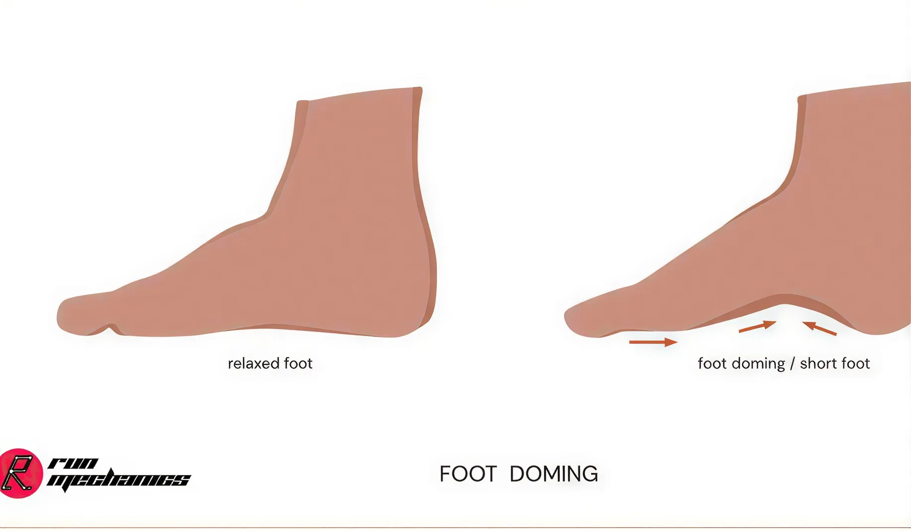 foot doming